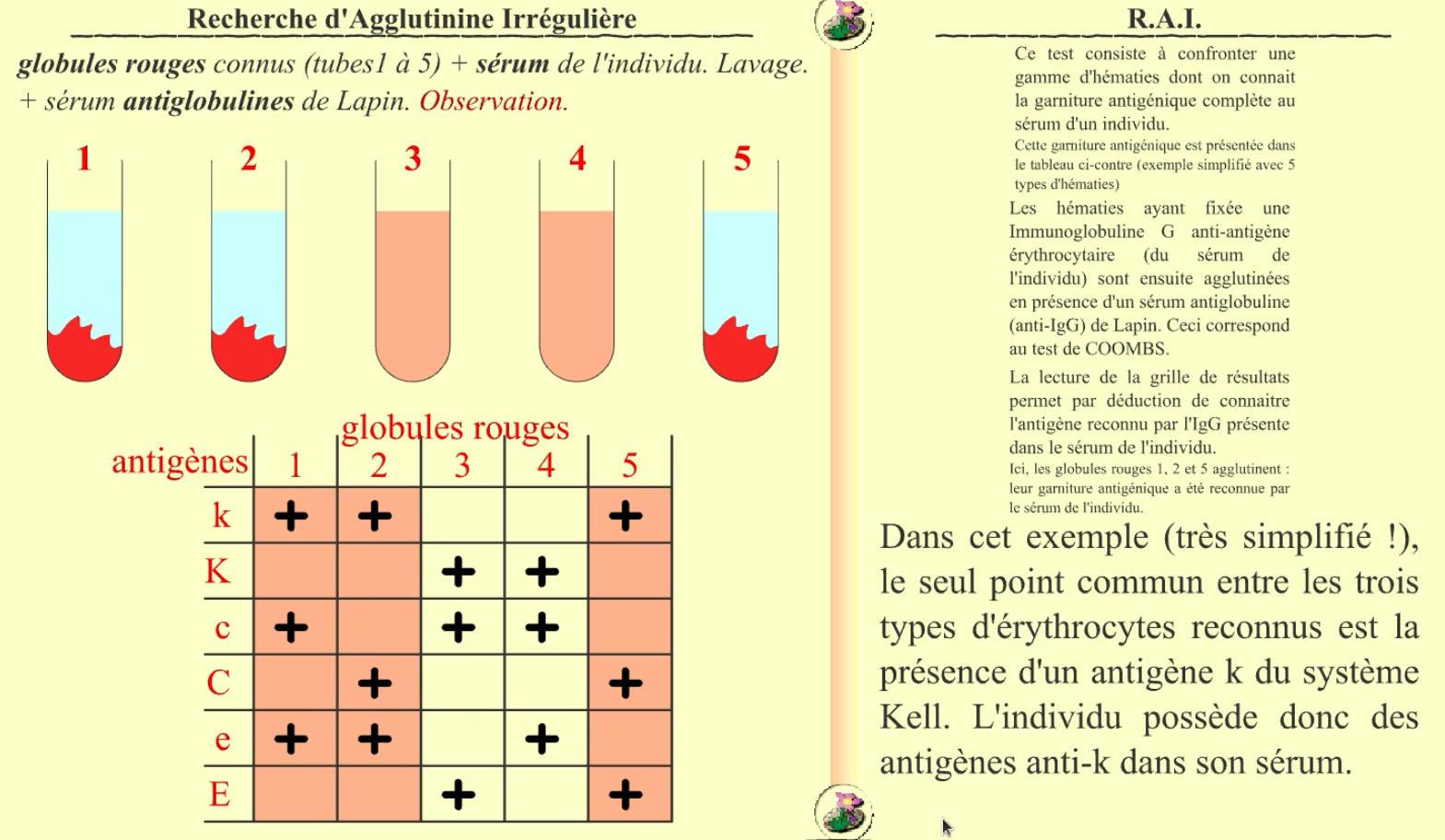 Recherche d’agglutinines irrégulières — free download